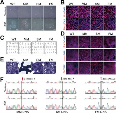 Endoplasmic Reticulum Stress Activation in Alport Syndrome Varies Between Genotype and Cell Type